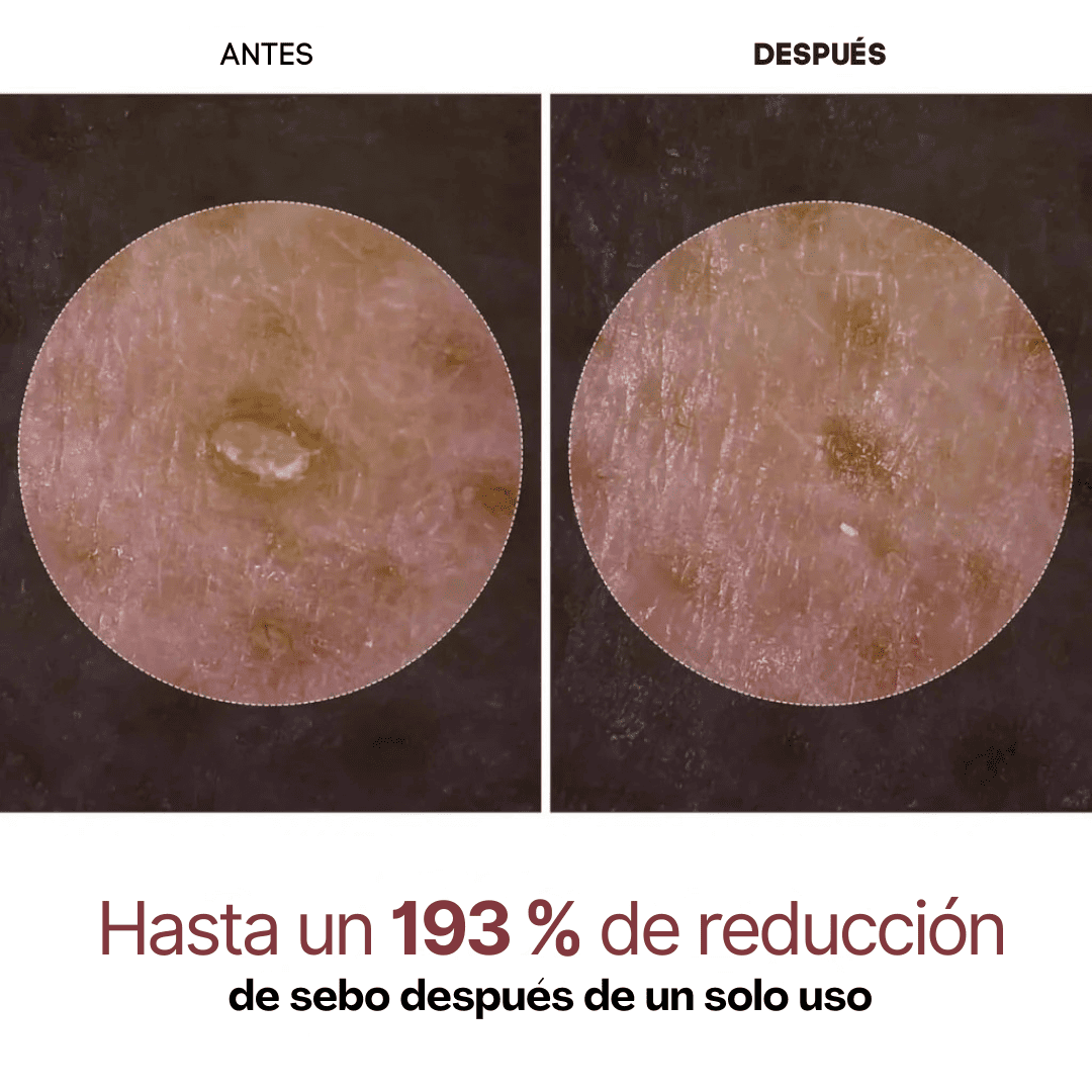 PureSkin Rice Peeling – Adiós Poros, Grasa y Manchas