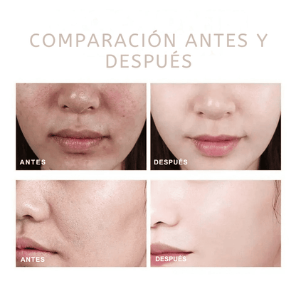 PureSkin Rice Peeling – Adiós Poros, Grasa y Manchas