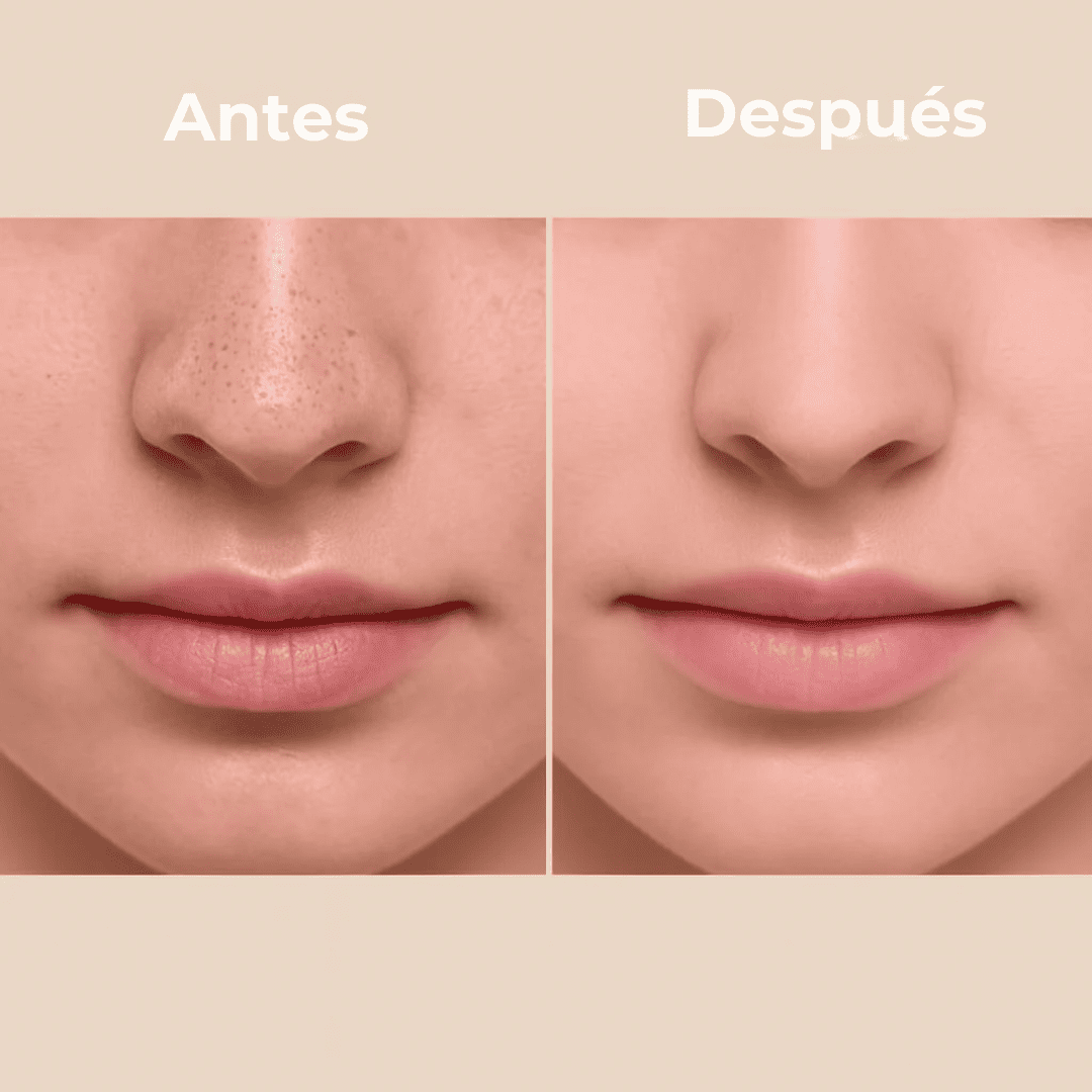 PureSkin Rice Peeling – Adiós Poros, Grasa y Manchas