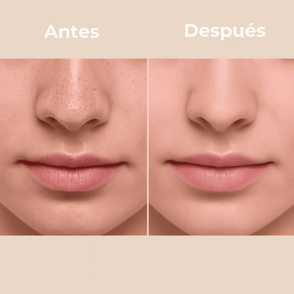 PureSkin Rice Peeling – Adiós Poros, Grasa y Manchas