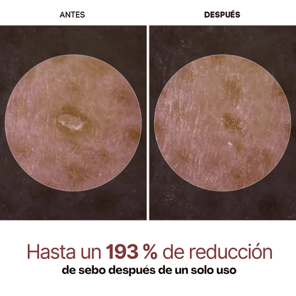 PureSkin Rice Peeling – Adiós Poros, Grasa y Manchas