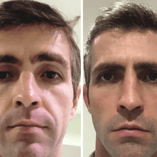 Korean Collagen Lift™ — Mascarilla Rejuvenecedora Coreana