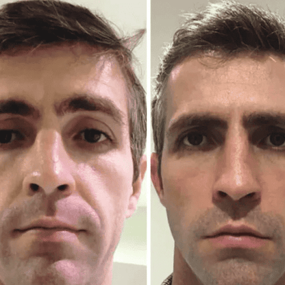 Korean Collagen Lift™ — Mascarilla Rejuvenecedora Coreana