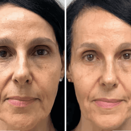 Korean Collagen Lift™ — Mascarilla Rejuvenecedora Coreana