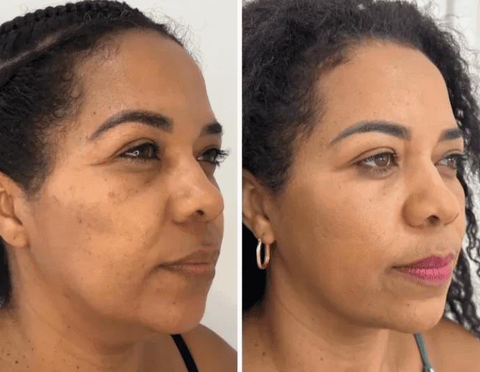 Korean Collagen Lift™ — Mascarilla Rejuvenecedora Coreana