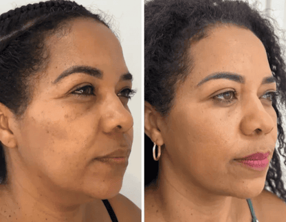 Korean Collagen Lift™ — Mascarilla Rejuvenecedora Coreana